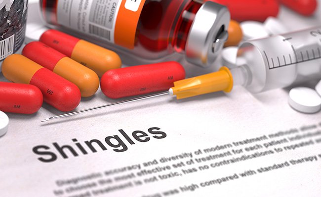 Shingles Prevention Now Possible Safecare Medical Center